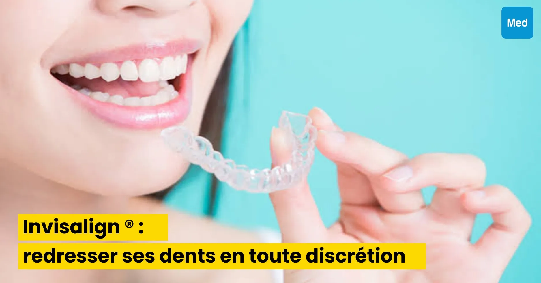Invisalign ® : redresser ses dents en toute discrétion grâce à l'orthodontie invisible
